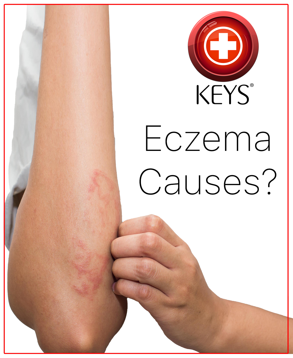 Eczema – It’s Probably the Chemicals in Your Life!